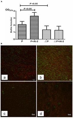 Autoinducer-2 Facilitates <mark class="highlighted">Pseudomonas aeruginosa PAO1</mark> Pathogenicity in Vitro and in Vivo